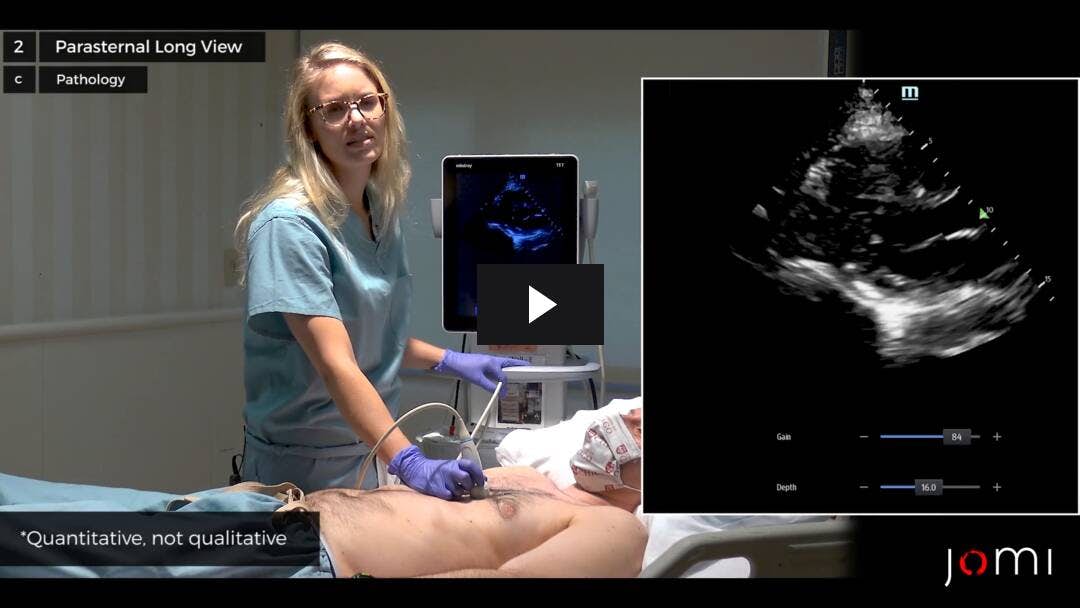 Video preload image for Einführung in Herzultraschall am Krankenbett