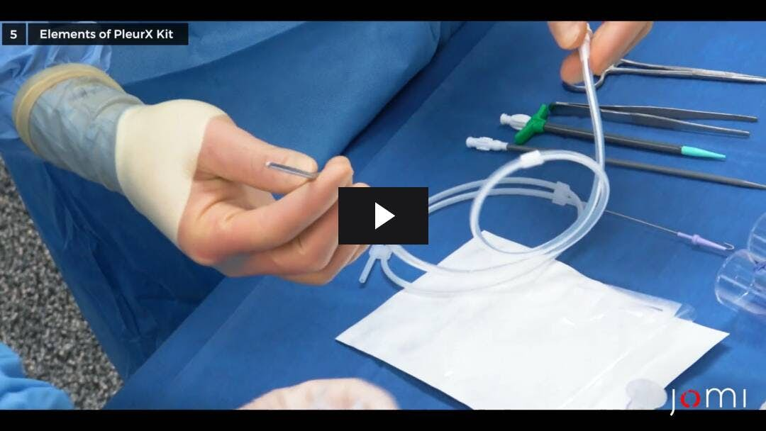 Video preload image for Insertion of a Right-Sided PleurX Catheter for Palliation of a Malignant Pleural Effusion