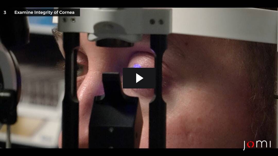 Video preload image for Corneal Staining with Fluorescein