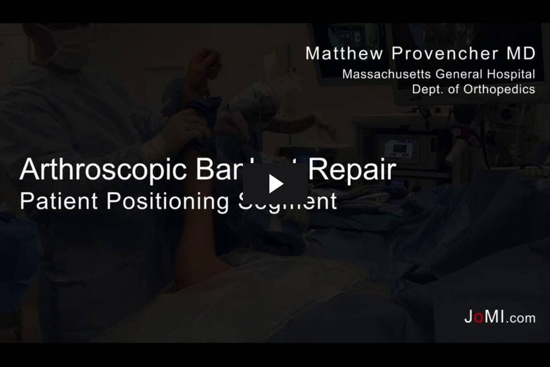 Video preload image for Lateral Patient Positioning for Shoulder Arthroscopy