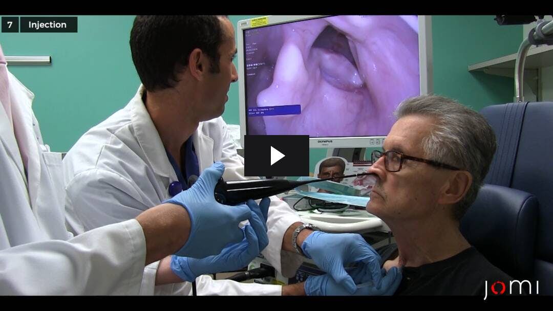 Video preload image for Inyección transcervical de las cuerdas vocales (en el consultorio)