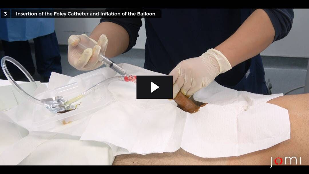 Video preload image for Male Foley Catheter Placement and Removal for Surgery