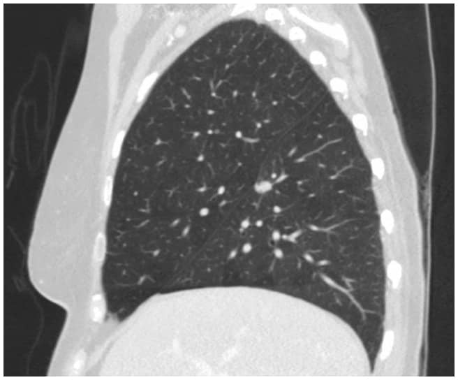 Fig.1b