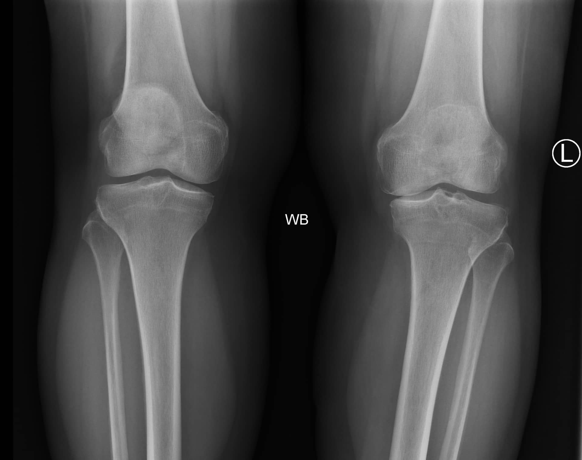 Fig.1a