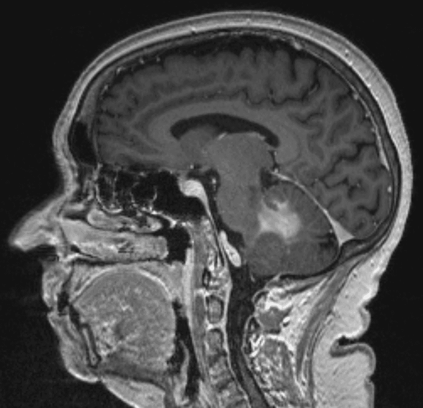 Fig.1c