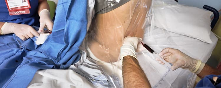 Neuraxial Ultrasound and Epidural Blood Patch for Post-dural Puncture Headache