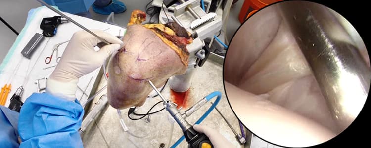 shoulder-arthroscopy-cadaver