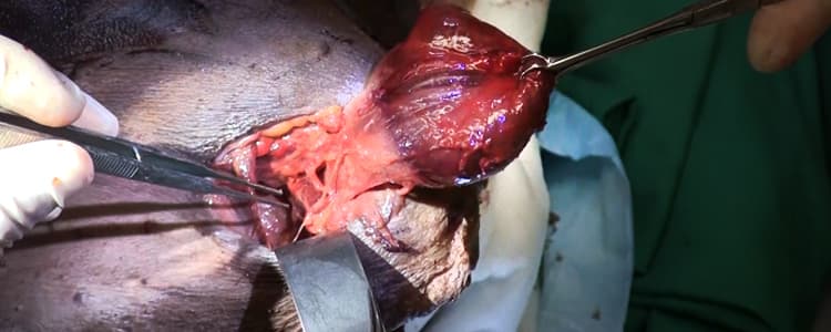 thyroidectomy-cadaver