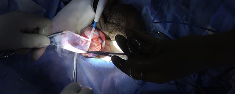 scrotal-hydrocelectomy-made-simple-during-a-surgical-mission