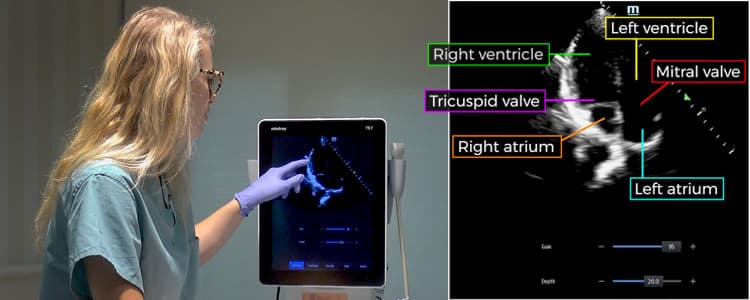 introduction-to-bedside-cardiac-ultrasound