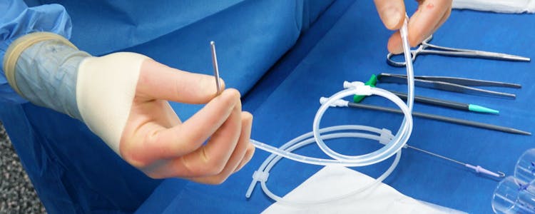 insertion-of-a-right-sided-pleurx-catheter-for-palliation-of-a-malignant-pleural-effusion