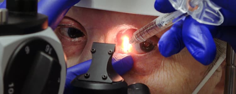 lacrifill-injection-into-punctum-for-dry-eyes