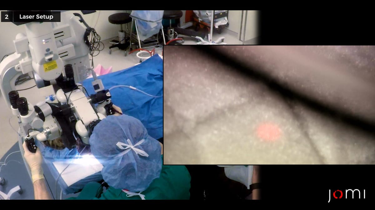 Myringoplasty and Tympanostomy Tube Placement JOMI