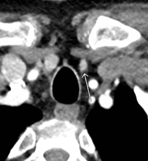 Fig. 1c