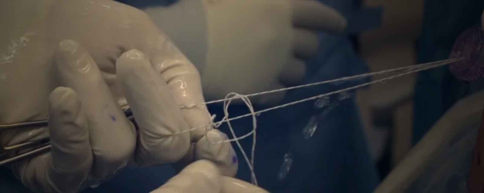 tying-arthroscopic-knot-glenoid-suture-anchor