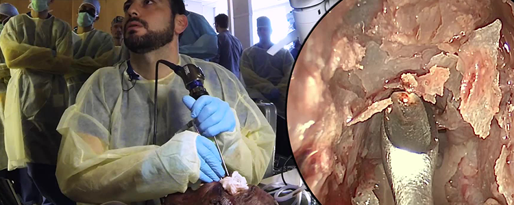 정면 부비동 해부 (시체) | Journal of Medical Insight