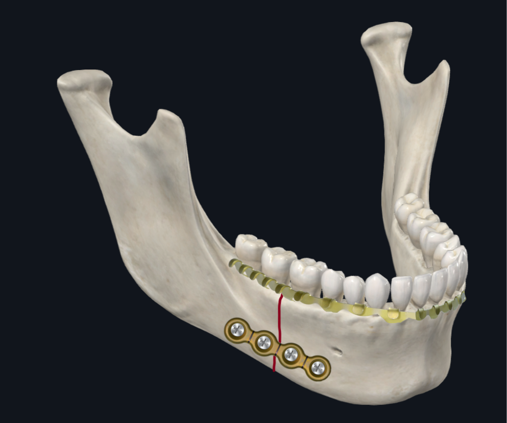 0414Figure6c